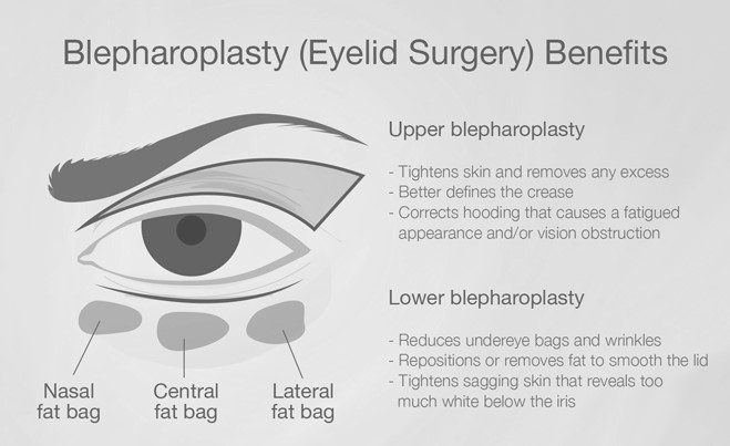 Best Blepharoplasty Surgery in Mumbai, eyelid Treatment at Affordable Price Cost India by Dr Debraj Shome at The Esthetic Clinics
